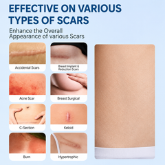 Scar Soothing Gel ( Buy 1 Get 1 Free )